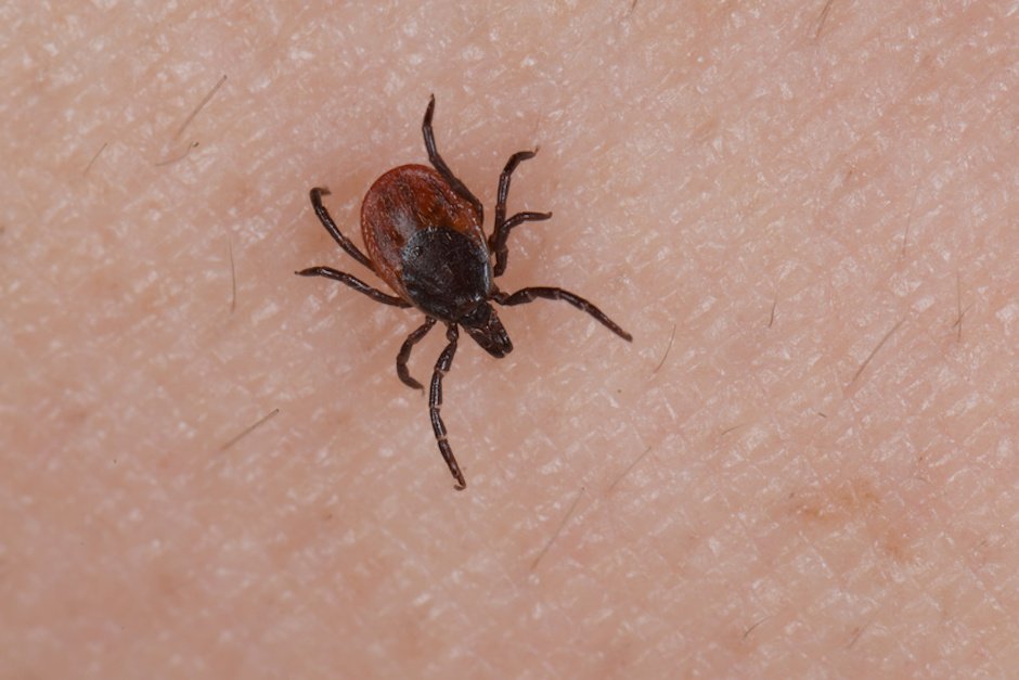 Holzbock Zecke (Ixodes ricinus) auf Haut